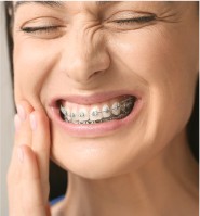 Urgence dentaire au cabinet d'orthodontie Easy Smile à Nantes